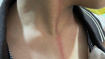 تحقيق عاجل في واقعة تعدٍ على تلميذ داخل مدرسة بميت غمر في الدقهلية - الخليج الان