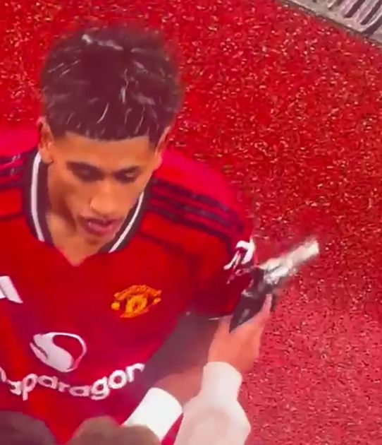 مسدس بلاستيك يربك جوهرة مانشستر يونايتد