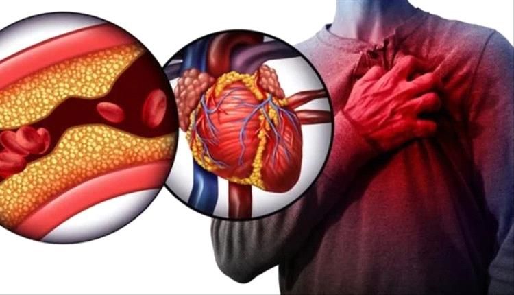 أسباب ارتفاع الكوليسترول الضار وطرق الوقاية والعلاج