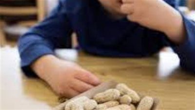 «دراسة سويدية :تكشف كيف يتم علاج حساسية الأطفال وسر الفول السوداني؟ - الخليج الان