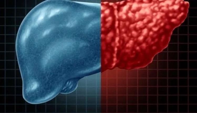 أطعمة صحية لمرضى الكبد الدهني.. تعرف عليها