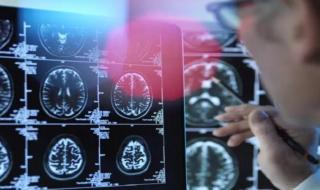 دراسة حديثة: العادات الصحية اليومية تبطئ شيخوخة الدماغ