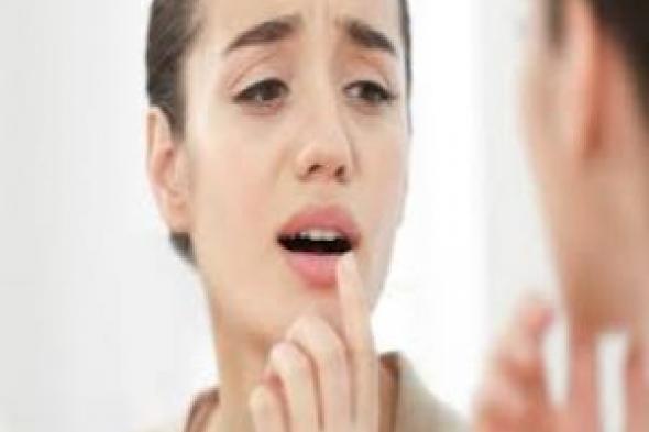 تعرف على أسباب حدوث تقرحات الفم وكيفية الوقاية منها