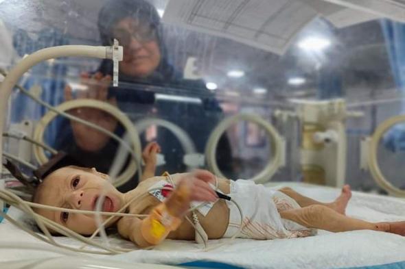 تفاصيل قاسية.. الطفلة ليلى تواجه الجوع بعد مقتل عائلتها في غزة